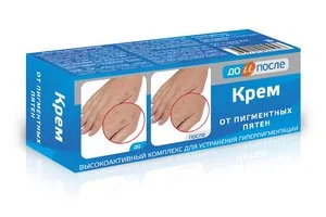 До И После Крем От Пигментных Пятен 50 мл