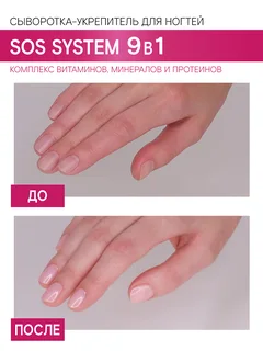 Сыворотка-укрепитель для ногтей Luxvisage SOS system 9 в 1 9 гр